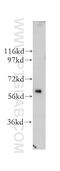 Cerebellar Degeneration Related Protein 2 antibody, 11611-2-AP, Proteintech Group, Western Blot image 