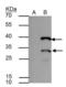 Hes Family BHLH Transcription Factor 1 antibody, NBP1-30912, Novus Biologicals, Immunoprecipitation image 