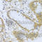 Acid Phosphatase antibody, A1801, ABclonal Technology, Immunohistochemistry paraffin image 