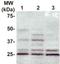 Rho GDP-dissociation inhibitor 1 antibody, TA354871, Origene, Western Blot image 