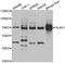 5'-Aminolevulinate Synthase 1 antibody, A10405, Boster Biological Technology, Western Blot image 