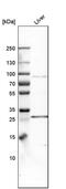Solute Carrier Family 27 Member 3 antibody, PA5-52364, Invitrogen Antibodies, Western Blot image 