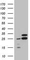 Ribosomal Protein L10 antibody, LS-C799597, Lifespan Biosciences, Western Blot image 
