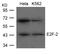 E2F Transcription Factor 2 antibody, TA347847, Origene, Western Blot image 