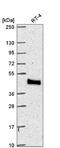 Myotubularin-related protein 9 antibody, NBP2-57980, Novus Biologicals, Western Blot image 