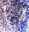 Fc Fragment Of IgE Receptor II antibody, PB9051, Boster Biological Technology, Immunohistochemistry paraffin image 