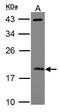 ADP-ribosylation factor 3 antibody, GTX104782, GeneTex, Western Blot image 