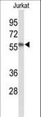 Phosphatidylinositide phosphatase SAC1 antibody, LS-B11784, Lifespan Biosciences, Western Blot image 