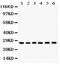 CD256 antibody, PB9523, Boster Biological Technology, Western Blot image 