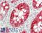Keratin 20 antibody, LS-B13607, Lifespan Biosciences, Immunohistochemistry paraffin image 