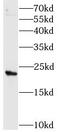 HsMAD2 antibody, FNab04924, FineTest, Western Blot image 