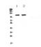 Signal Transducer And Activator Of Transcription 2 antibody, A01360, Boster Biological Technology, Western Blot image 