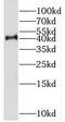 Lysine Methyltransferase 5A antibody, FNab07770, FineTest, Western Blot image 