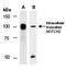 Melanocortin 4 Receptor antibody, orb67093, Biorbyt, Western Blot image 