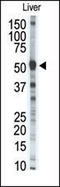 Matrix Metallopeptidase 8 antibody, AP13186PU-N, Origene, Western Blot image 