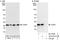 Catechol O-methyltransferase antibody, A303-631A, Bethyl Labs, Western Blot image 