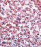 Cytochrome P450 Family 2 Subfamily C Member 9 antibody, 63-259, ProSci, Immunohistochemistry paraffin image 