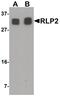 RILP-like protein 2 antibody, PA5-34359, Invitrogen Antibodies, Western Blot image 