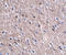 Cell Death Inducing P53 Target 1 antibody, A10988, Boster Biological Technology, Immunohistochemistry frozen image 