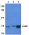 CD20 antibody, A03780-1, Boster Biological Technology, Western Blot image 