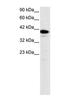Nuclear Trans. Factor Y alpha-1 antibody, PA1-24434, Invitrogen Antibodies, Western Blot image 