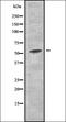 5 -AMP-activated protein kinase catalytic subunit alpha-2 antibody, orb337083, Biorbyt, Western Blot image 