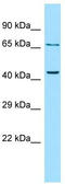 Parathyroid Hormone 2 Receptor antibody, TA338168, Origene, Western Blot image 