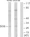 Homeobox protein SIX6 antibody, abx013343, Abbexa, Western Blot image 