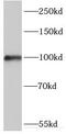Myosin ID antibody, FNab05505, FineTest, Western Blot image 