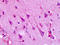5-Hydroxytryptamine Receptor 1F antibody, TA340658, Origene, Immunohistochemistry paraffin image 