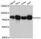 RIO Kinase 2 antibody, abx126482, Abbexa, Western Blot image 