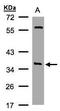 NSF Attachment Protein Alpha antibody, GTX106626, GeneTex, Western Blot image 