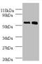 Bone morphogenetic protein 3 antibody, A52753-100, Epigentek, Western Blot image 