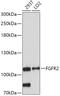 Fibroblast Growth Factor Receptor 2 antibody, 18-480, ProSci, Western Blot image 