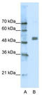 Cholinergic Receptor Nicotinic Alpha 9 Subunit antibody, TA330425, Origene, Western Blot image 