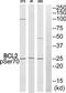 BCL2 antibody, TA326053, Origene, Western Blot image 