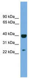 Suppressor Of Cytokine Signaling 1 antibody, TA346365, Origene, Western Blot image 