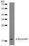 Synuclein Alpha antibody, AP09475PU-N, Origene, Western Blot image 