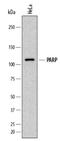 Poly(ADP-Ribose) Polymerase 1 antibody, AM33417PU-N, Origene, Western Blot image 