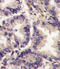 Vascular Endothelial Growth Factor C antibody, LS-C97706, Lifespan Biosciences, Immunohistochemistry paraffin image 