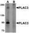 Pappalysin-2 antibody, TA319996, Origene, Western Blot image 