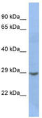 Homeobox protein Nkx-2.2 antibody, TA329799, Origene, Western Blot image 