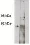 Notum, Palmitoleoyl-Protein Carboxylesterase antibody, orb109018, Biorbyt, Western Blot image 