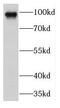 Beaded Filament Structural Protein 1 antibody, FNab03130, FineTest, Western Blot image 