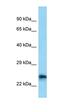 Calneuron 1 antibody, orb326425, Biorbyt, Western Blot image 