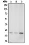 Caveolin 1 antibody, LS-C351942, Lifespan Biosciences, Western Blot image 