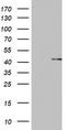 Ornithine Carbamoyltransferase antibody, TA802602, Origene, Western Blot image 
