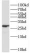 Chromatin Target Of PRMT1 antibody, FNab01069, FineTest, Western Blot image 