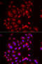 Sulfate transporter antibody, 22-165, ProSci, Immunofluorescence image 
