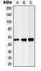 Hepatic lipase antibody, orb214195, Biorbyt, Western Blot image 